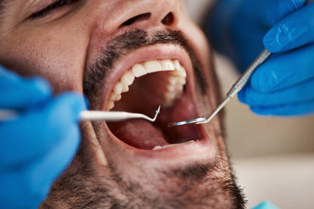 Best Emergency Tooth Extraction in Lake Delton, WI