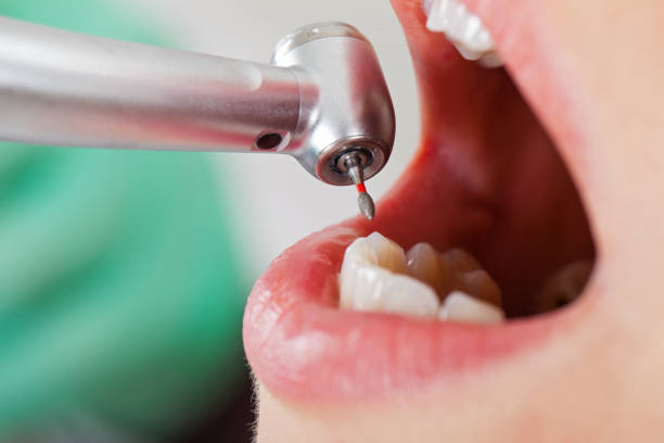 Best Emergency Treatment for Toothache in Lake Delton, WI